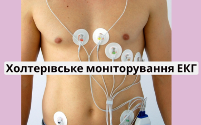 ХОЛТЕР ЕКГ в Кропивницькому на 24 години, 48 годин, 72 години, 4 доби, 5 діб, 6 діб, 7 діб
