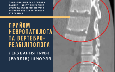 ЕФЕКТИВНЕ ЛІКУВАННЯ ГРИЖІ ХРЕБТА В КРОПИВНИЦЬКОМУ
