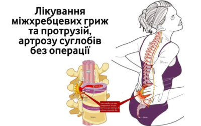 Лікування міжхребцевих гриж та протрузій, артрозу суглобів без операції. Невропатолог в Кропивницькому